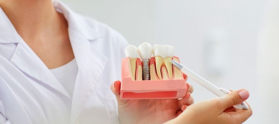 implantes dentales en alcorcón y San Cristóbal